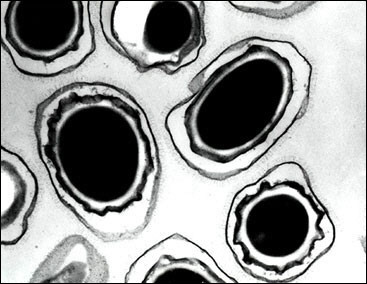 Microscope view of bacillus anthrax spores. Suspected anthrax bacteria was detected at a mail delivery facility at the Pentagon and at another satellite facility, but subsequent tests have proved negative, the US Defense Department said. [AFP/File] 