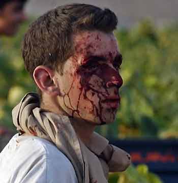 A wounded Israeli man stands at the scene of a train crash accident near the Kibbutz Revadim, June 21, 2005. [Reuters]